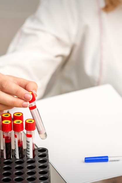 Анализ поджелудочной железы по крови – основные принципы и методы исследования