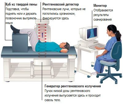 Денситометрия