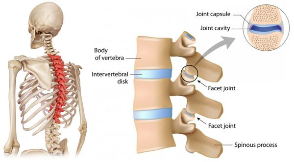 Поражение грудного отдела позвоночника и болевой синдром