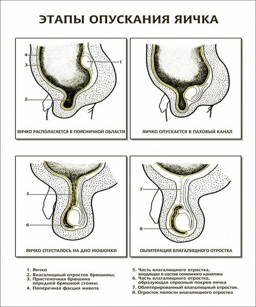 Этапы опускания яичка