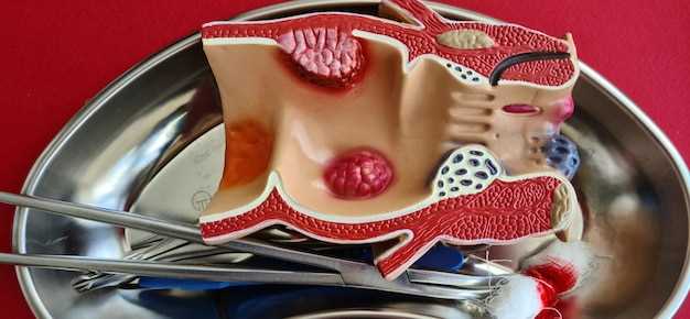 Гемангиома на половой губе: причины, симптомы, диагноз, лечение, восстановительный период и советы гинеколога