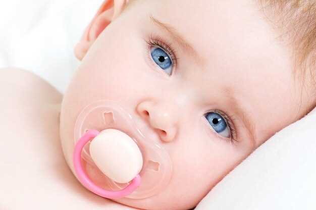 Признаки и причины молочницы у новорожденных