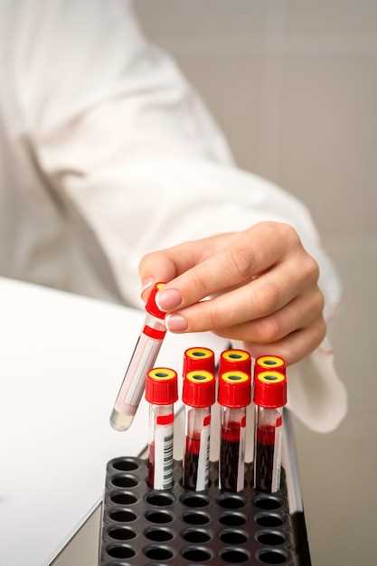 Подготовка к сдаче анализа на группу крови