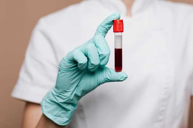 Процесс сдачи анализа крови на хламидии: шаги и рекомендации