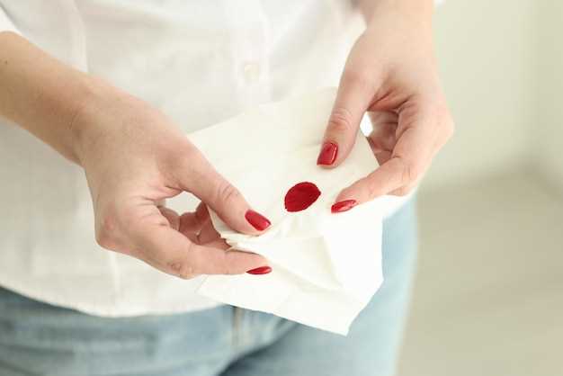 Причины появления крови в моче у женщин
