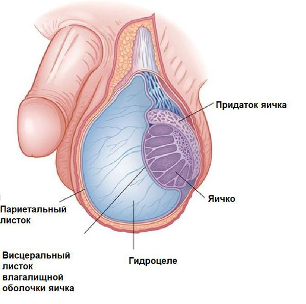 Опухание (увеличение) яичек, мошонки | Клиника урологии им. Сеченова