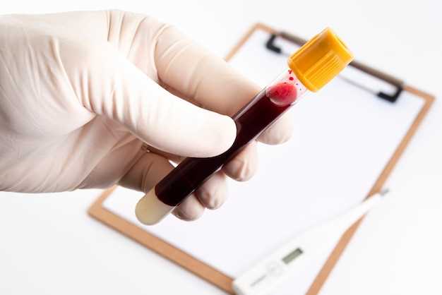 Важность общего анализа крови