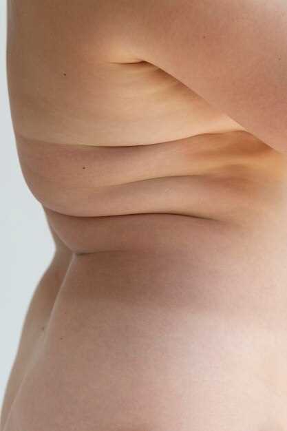 Что вызывает появление жировиков на теле?