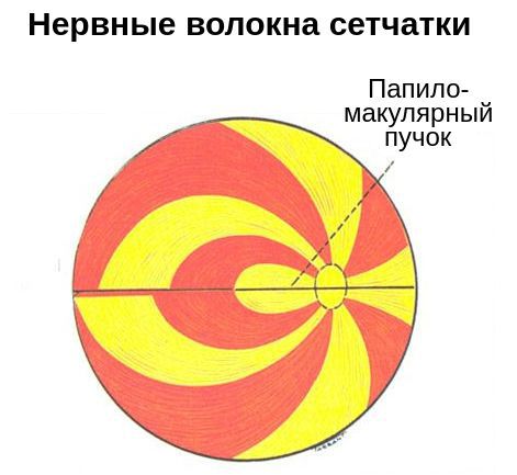 Повреждение нервных волокон в области папилломакулярного пучка