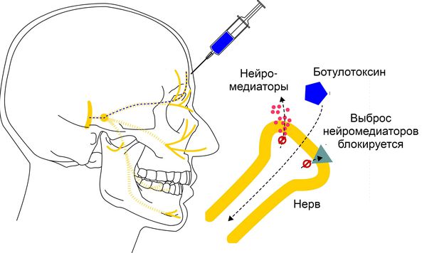 Действие ботулотоксина