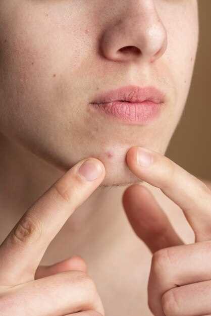 Почему появляются прыщи на щеках и как они связаны с органами