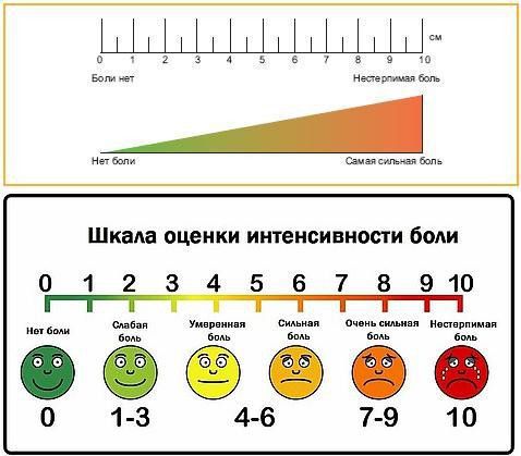 Визуально-аналоговая шкала, по которой оценивается интенсивность боли